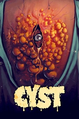 Cyst 2020